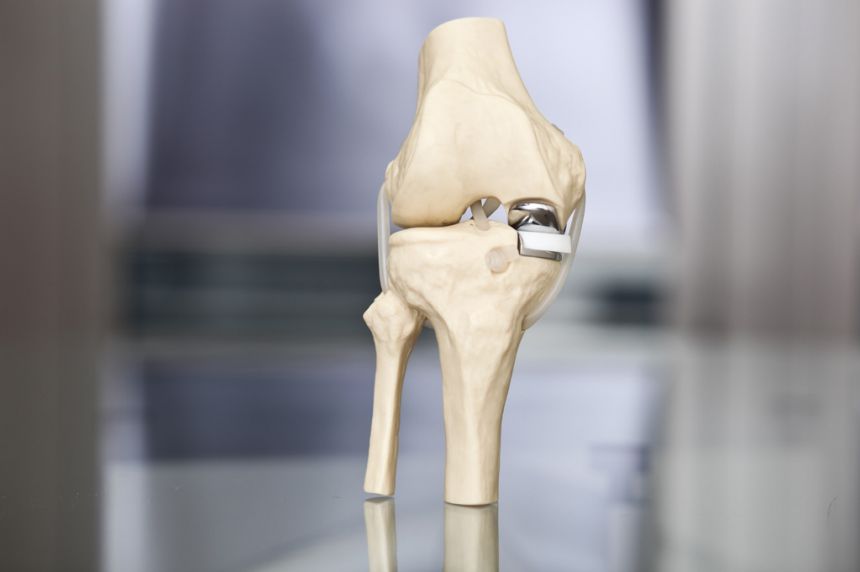 Beste Klinik Für Knie-op In Hannover